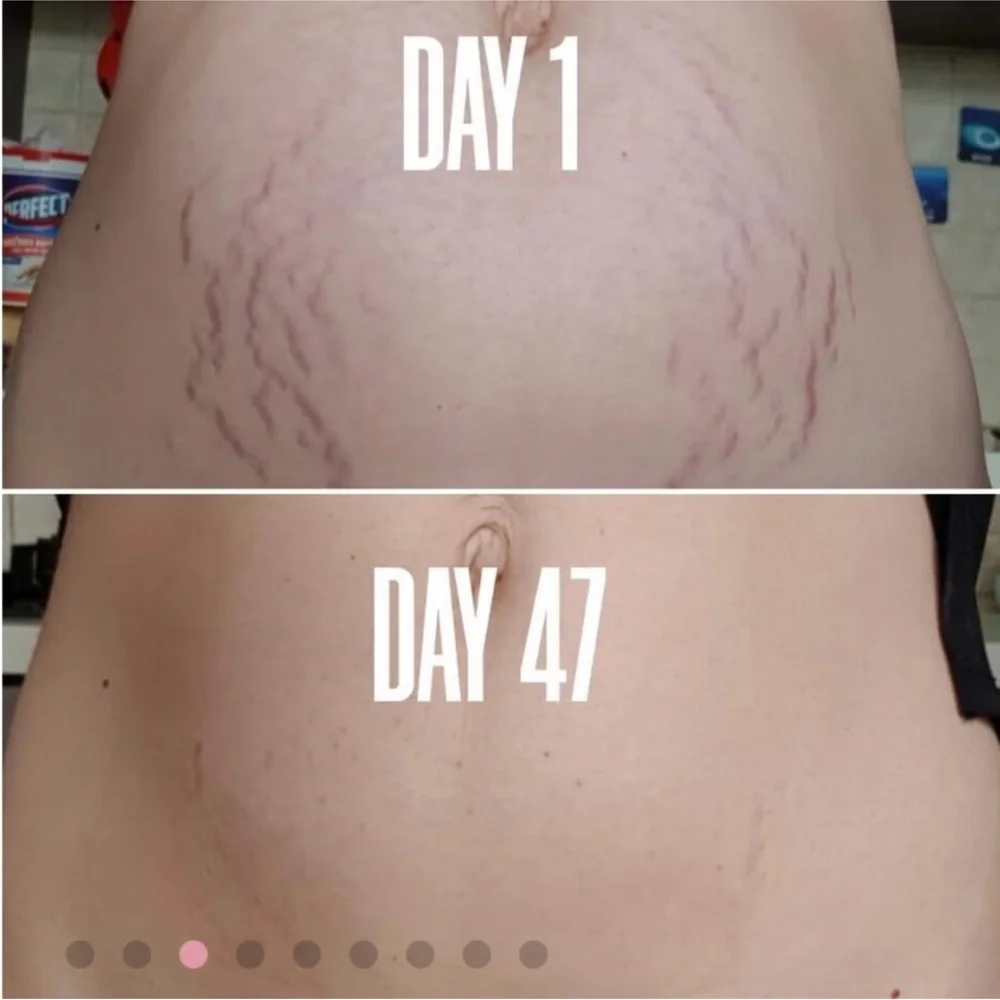 Maelys B-FLAT Belly Firming Cream. 2 available. - Picture 6 of 9